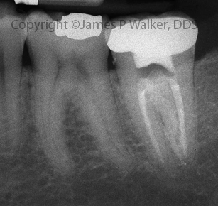 Molar